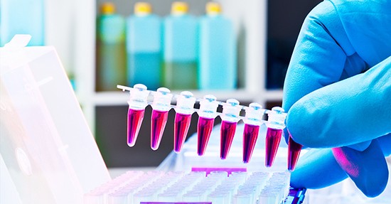 Analysis & Quality Control Analysis & Quality Control