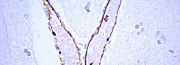 Anticorpi primari per Western Blot