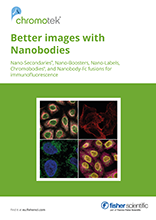 Better Images with Nanobodies