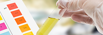 Chromatography Chromatography